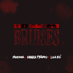 Bruises