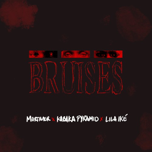 Bruises