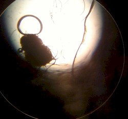 Vein