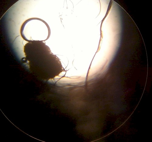 Vein