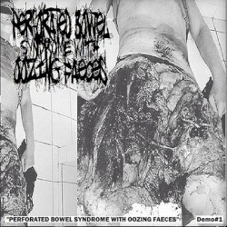 Perforated Bowel Syndrome With Oozing Faeces