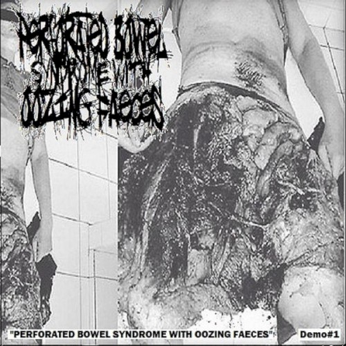 Perforated Bowel Syndrome With Oozing Faeces