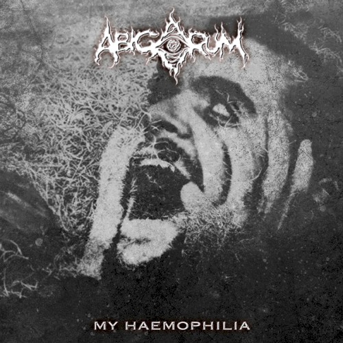 My Haemophilia