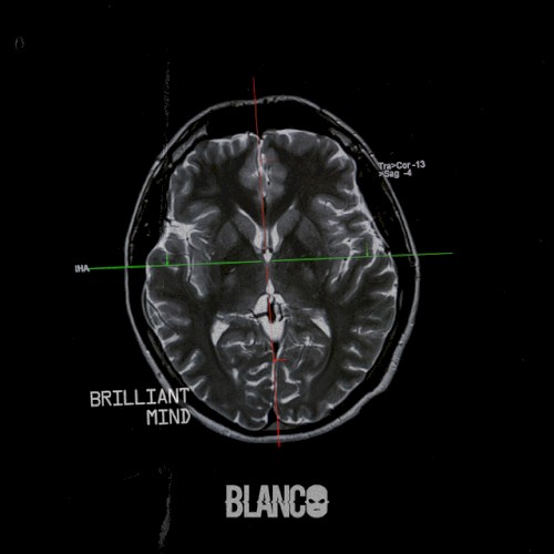 Brilliant Mind