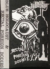 Blue Holocaust & Rectal Foreign Bodies