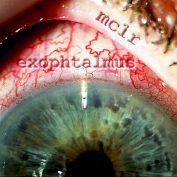Exophtalmus