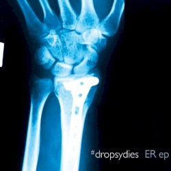 ER