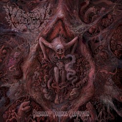 Aberrant Vaginal Gestation