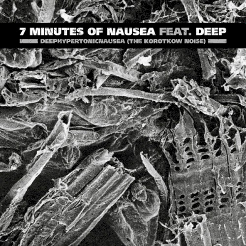 Deephypertonicnausea (The Korotkow Noise)