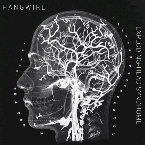 Exploding-Head Syndrome