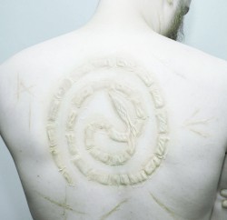 Scars