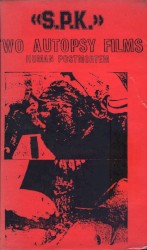 Two Autopsy Films: Human Postmortem
