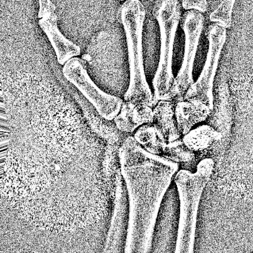 bones