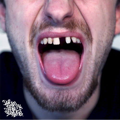 Drugs, Booze & Dental Issues