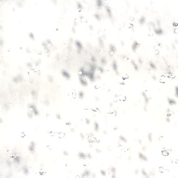 Schnee von gestern