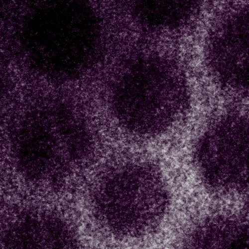 Ubiquitous