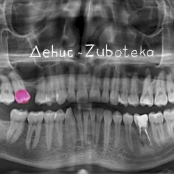 Zuboteka