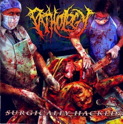 Surgically Hacked