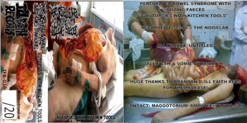 Autopsies With Kitchen Tools