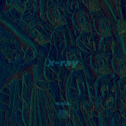 X-Ray