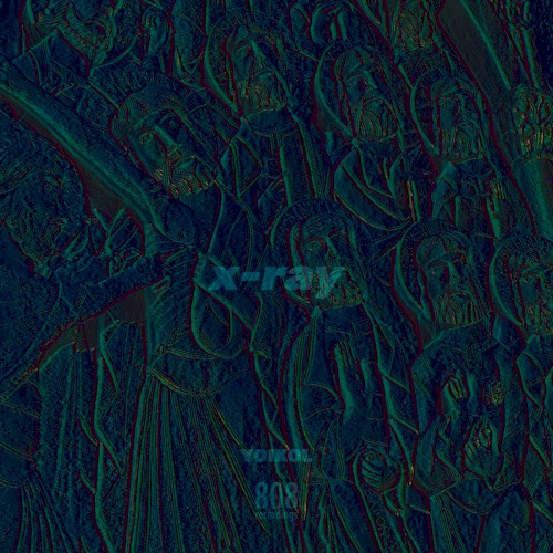 X-Ray