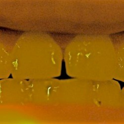 Azul, mis dientes