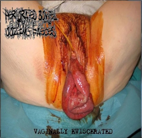 Vaginally Eviscerated