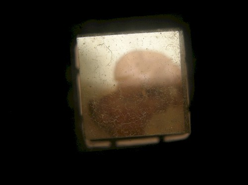 Through a pinhole: an ear, a nose, a throat