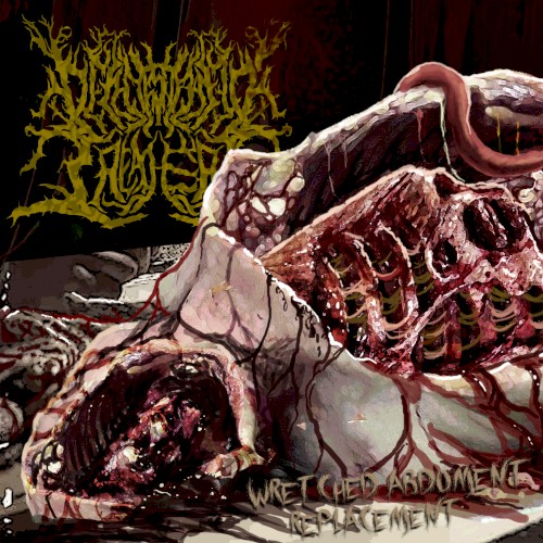 Wretched Abdoment Replacement