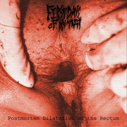 Postmortem Dilatation of the Rectum