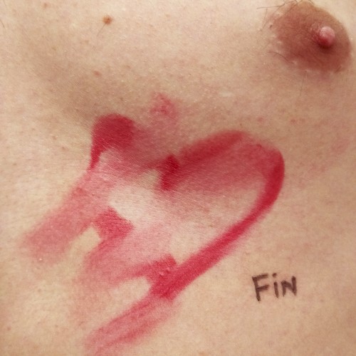 Fin