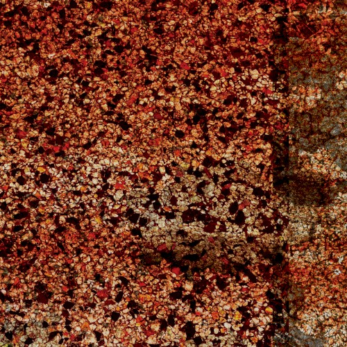 shingles