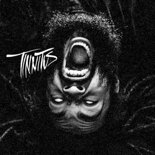 Tinnitus