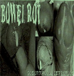 Gonorrhoea Infection