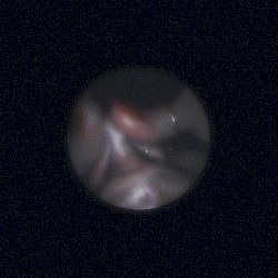 Satellite