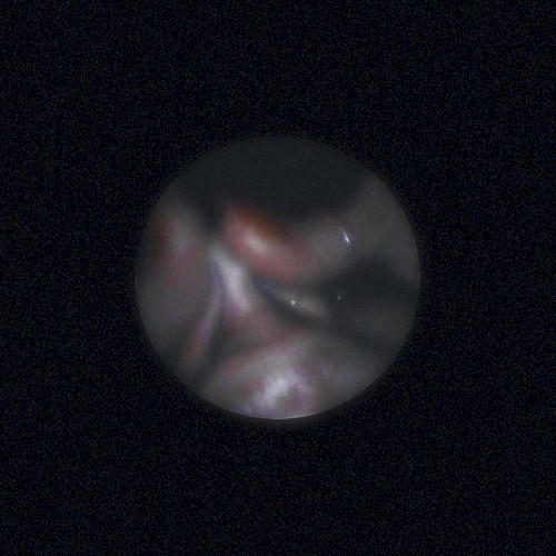 Satellite