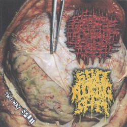 Two-Way Split