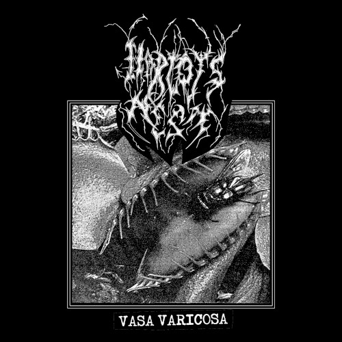 Vasa Varicosa