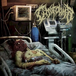 Chordoma