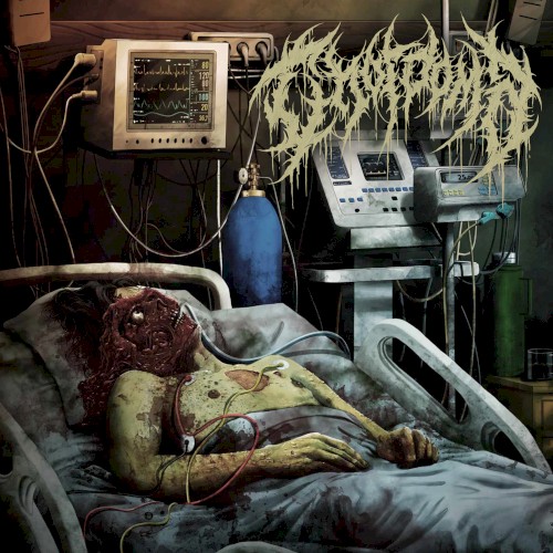 Chordoma