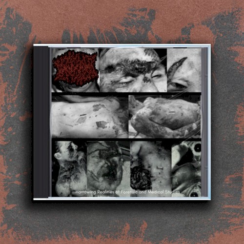 Harrowing Realities of Forensic and Medical Studies