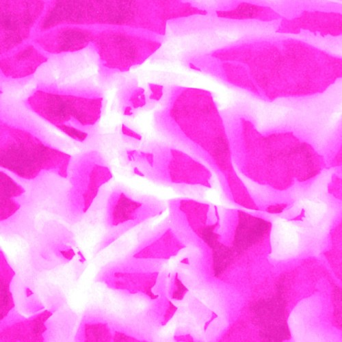 Mist Remixes