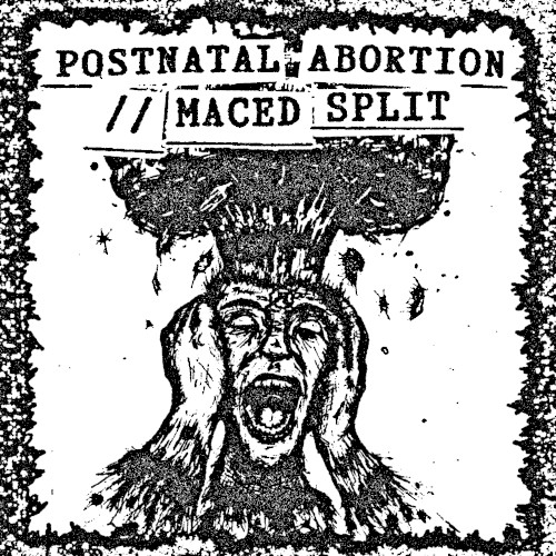 Maced / Postnatal Abortion