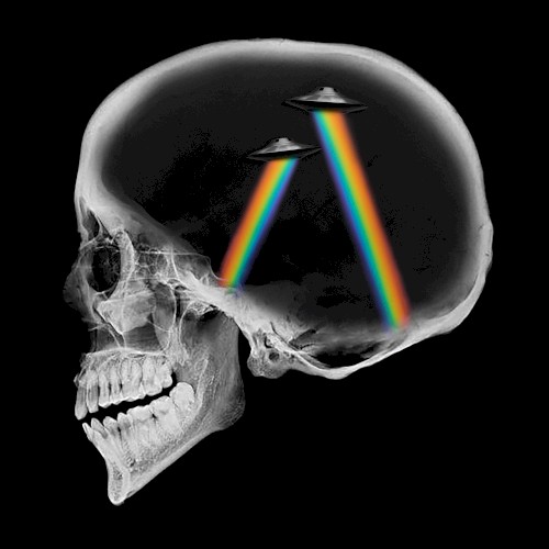 Dreamer (Remixes)