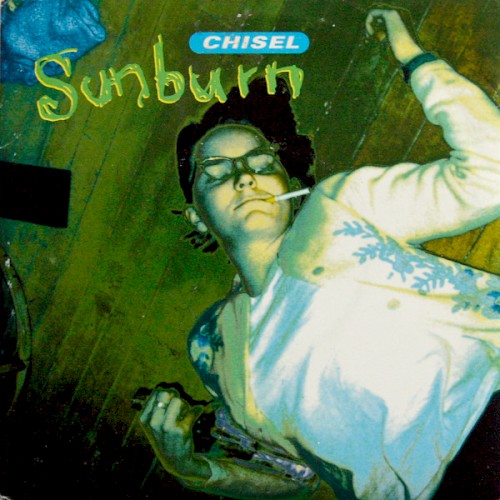 Sunburn