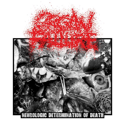 Neurologic Determination of Death