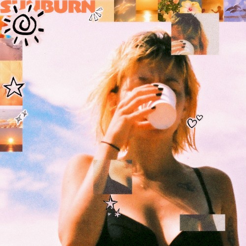 Sunburn