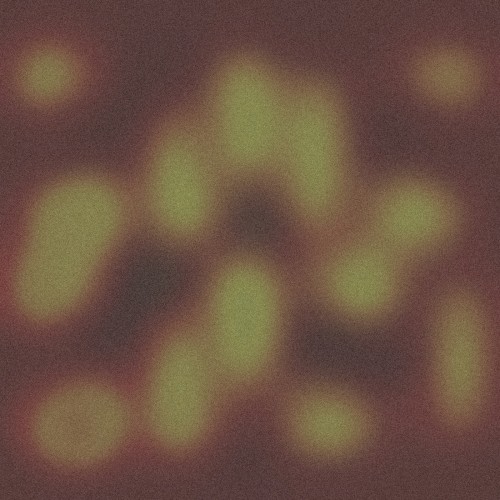 Soisong Broadcast #5