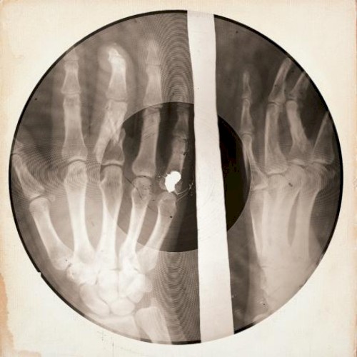 Happy X-Raymass
