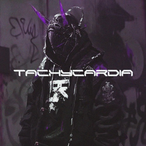 Tachycardia